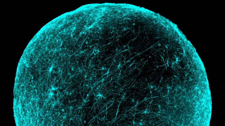 Neural organoid microscopy from Stanford’s Pașca Lab.