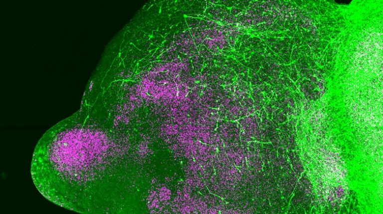 Fluorescence microscopy of neural cells from Stanford’s Pașca Lab.